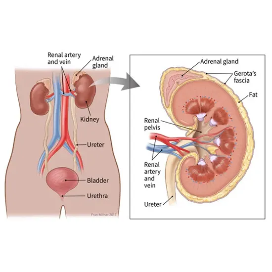 Ureter and Renal Pelvis Cancer - Symptoms, Types, Causes & Diagnosis